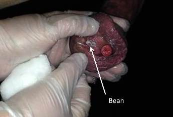 Sheath Cleaning_Bean_Cropped