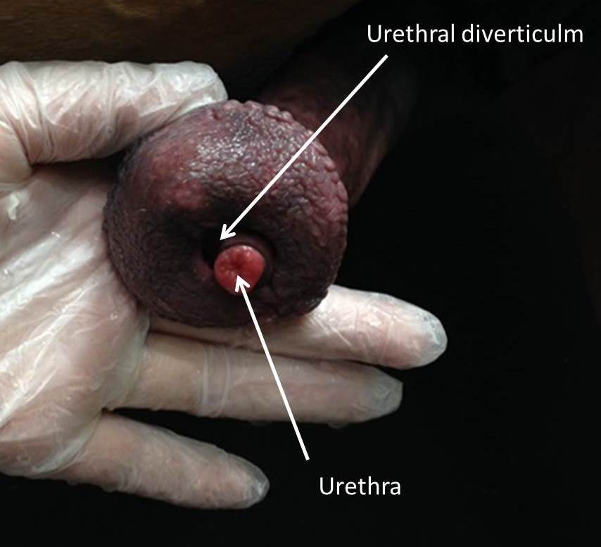 Sheath Cleaning_Urethra cropped