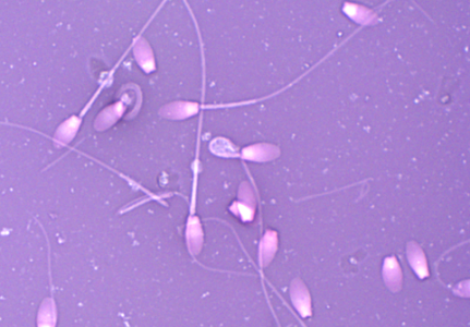 Sperm Accumulators_Sperm Photo cropped