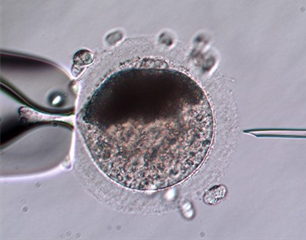 Trends in Equine Assisted Reproduction_ICSI