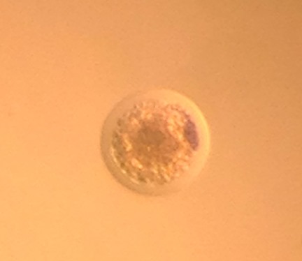 Embryo Vitrification_Embryo