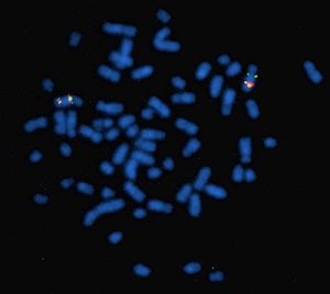 Genetics_Horse Chromosomes