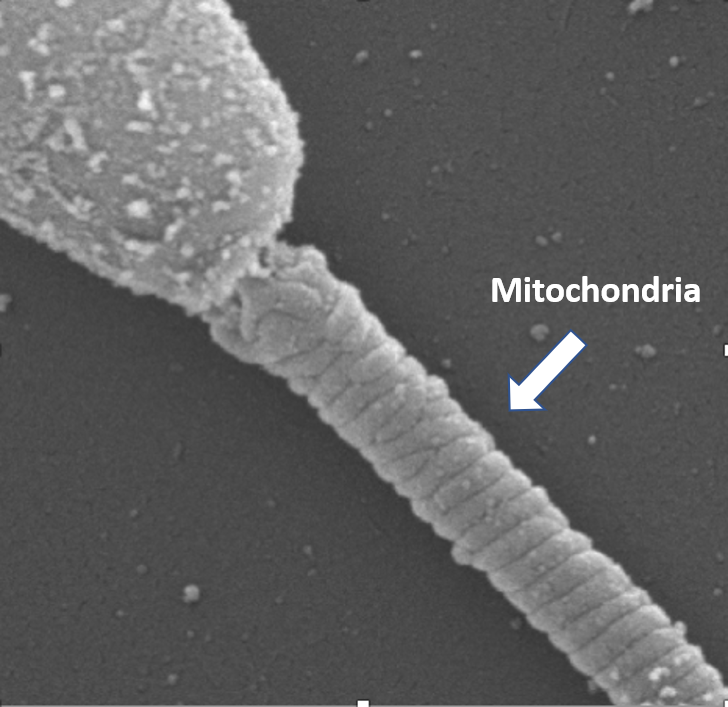 Sperm Mitochondria_Meyers with Tag